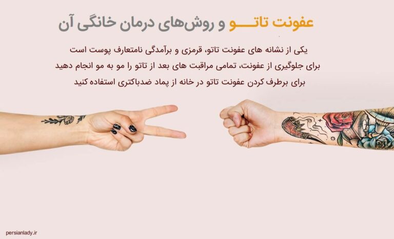 عفونت تاتو و روش‌های درمان خانگی آن