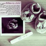 سونوگرافی ها و آزمایش های دوران بارداری