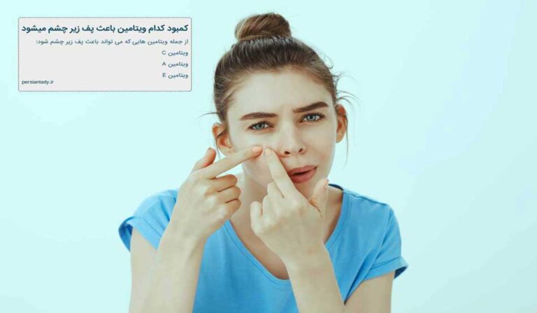 کمبود کدام ویتامین باعث پف زیر چشم می شود؟