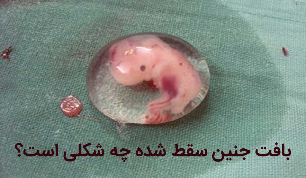 بافت جنین سقط شده چه شکلی است؟