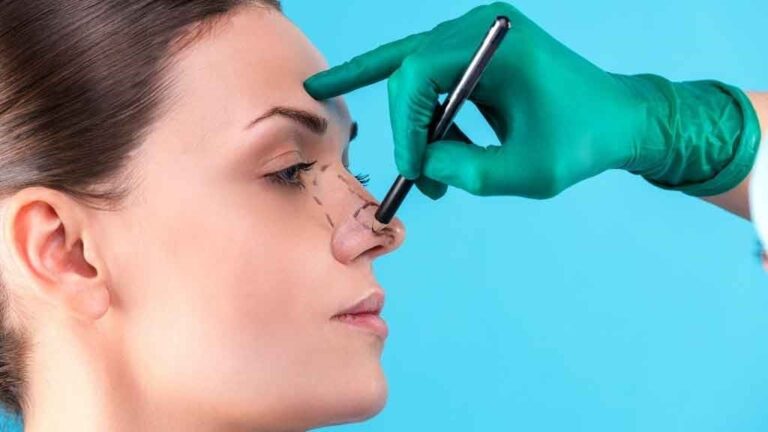 جراح بینی در شیراز یا سایر شهرها باید چه ویژگی هایی داشته باشند؟
