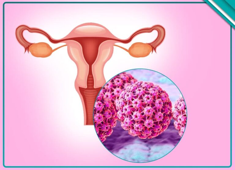 شایع ترین روش های انتقال زگیل تناسلی را بشناسید