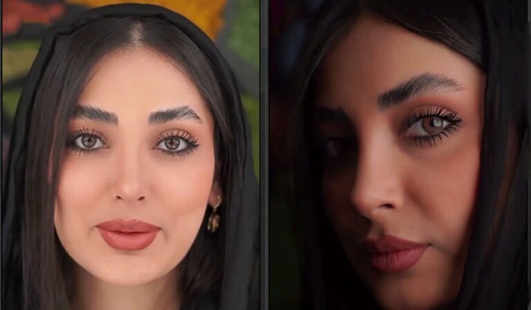 جراحی بینی گوشتی توسط دکتر بشارتی زاده تجربه‌ای ماندگار از زیبایی طبیعی