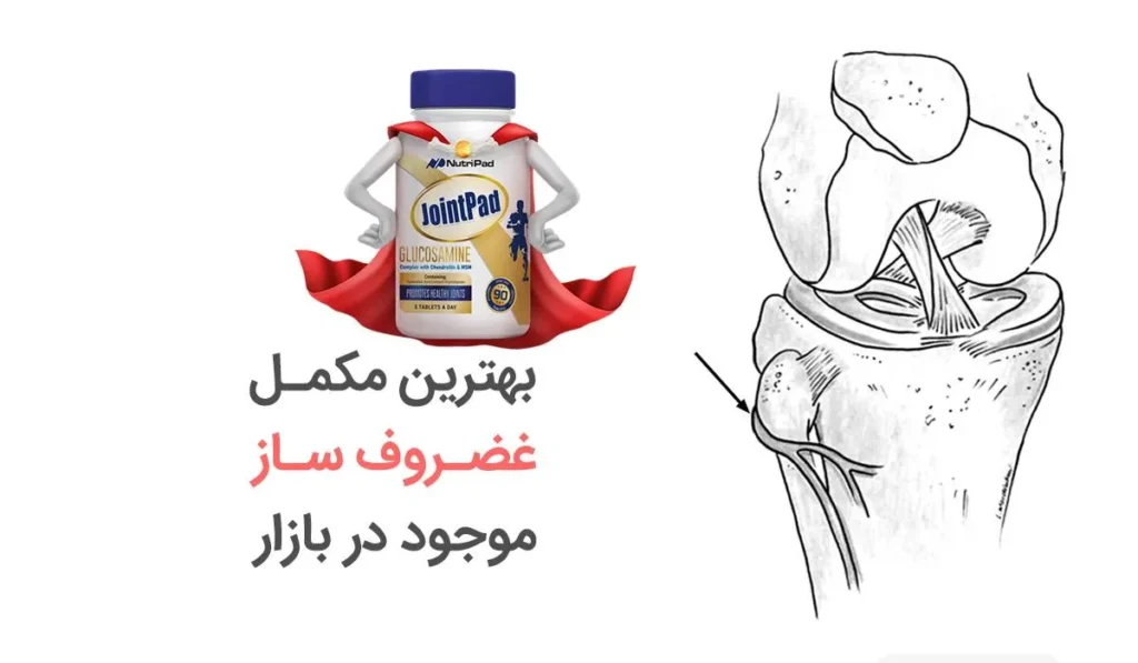 راهکارهای مؤثر برای سلامت استخوان‌ و مفاصل