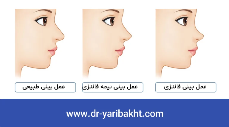 انواع مدل های جراحی بینی: از طبیعی تا فانتزی، کدامیک برای شما مناسب‌تر است؟
