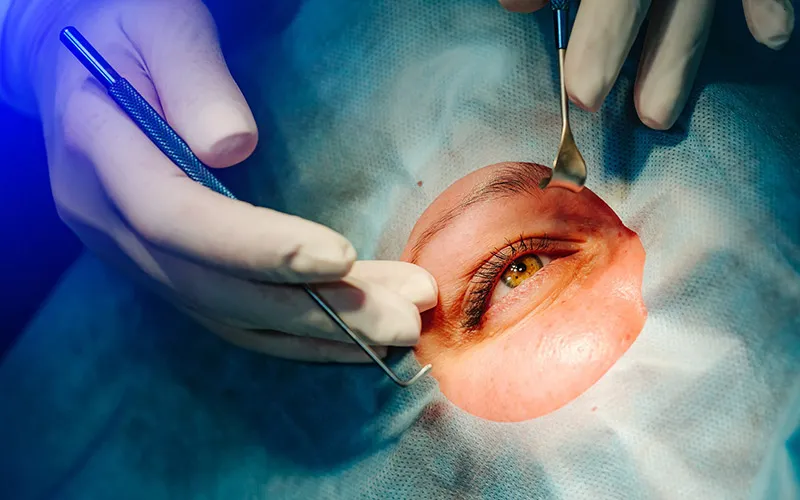 همه چیز درباره بهترین و جدیدترین عمل برای مشکلات چشم + مقایسه با روش‌های قدیمی