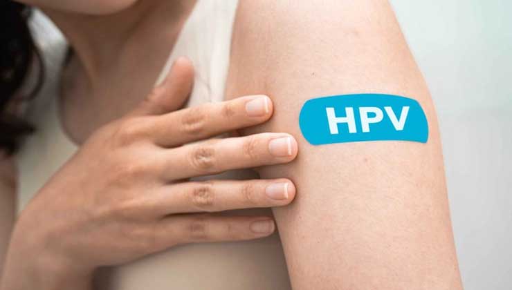 10 نکته که باید درباره زگیل مقعدی بدانید hpv