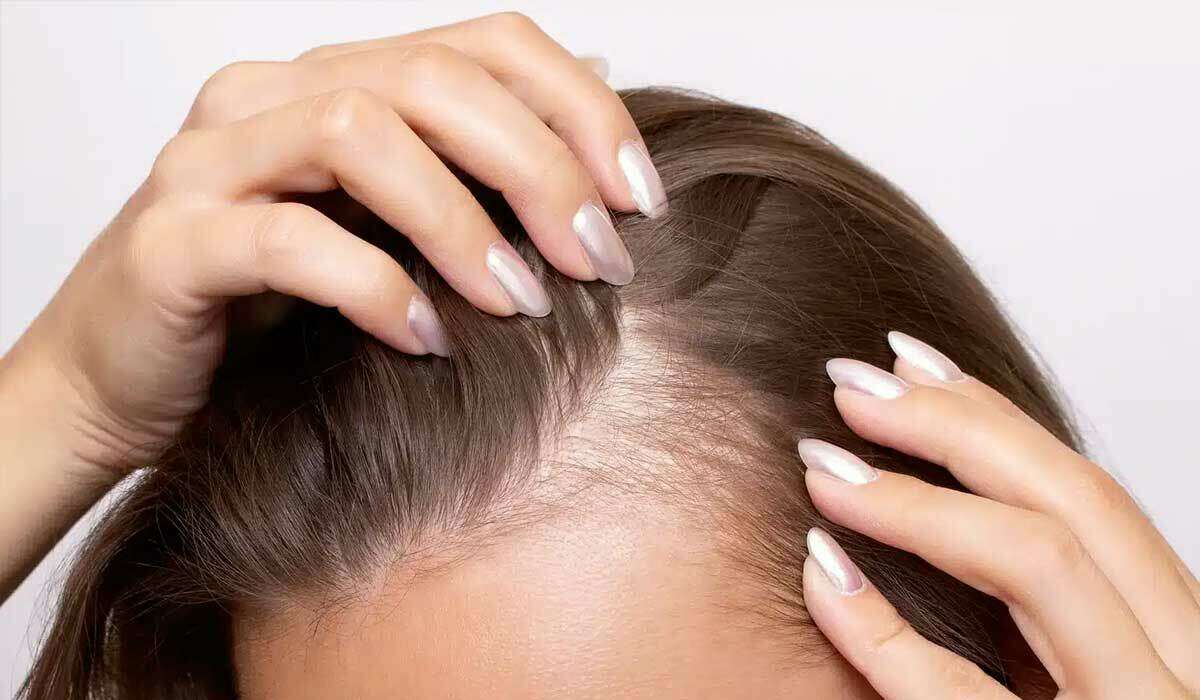 برای محافظت از موهای آسیب دیده چه راهکاری وجود دارد؟ برای محافظت از موهای آسیب دیده چه راهکاری وجود دارد؟