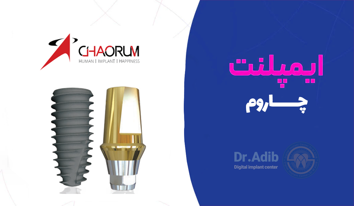 محاسبه آنلاین قیمت ایمپلنت دندان | برندهای ایمپلنت کره ای و سوئیسی