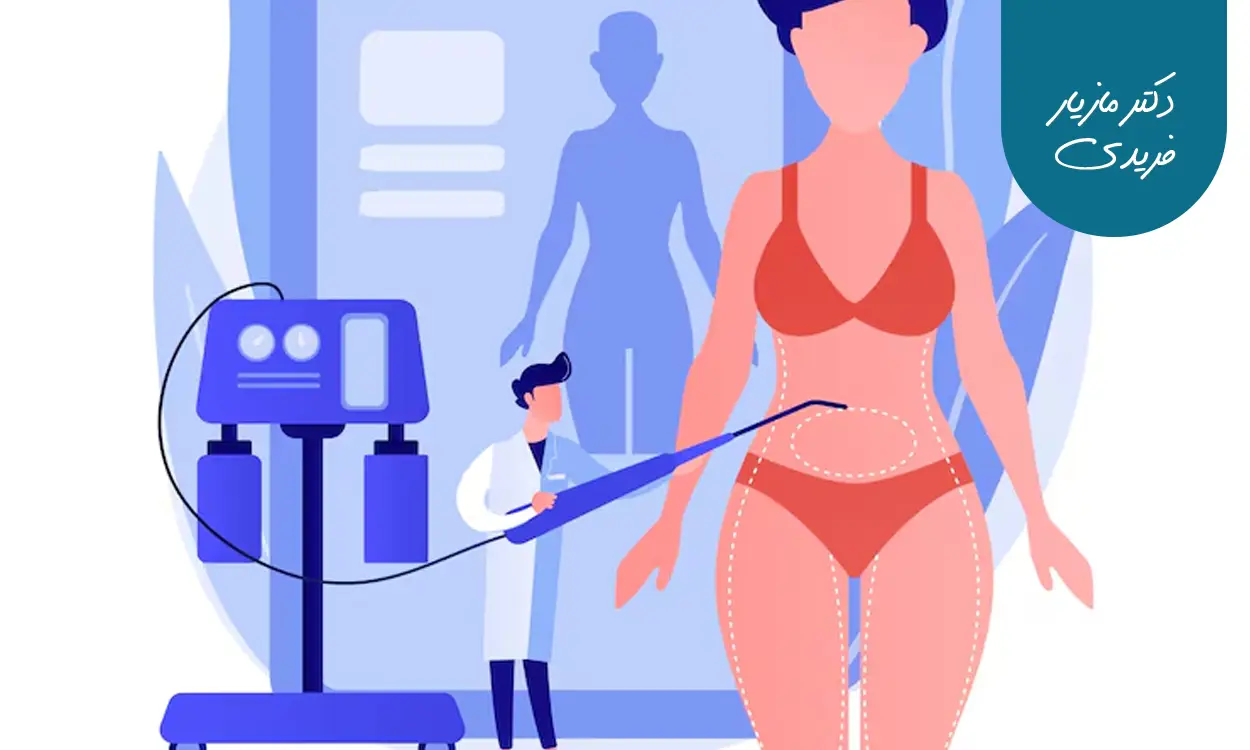 معرفی 10 تا از بهترین جراحان لیپوماتیک در ایران