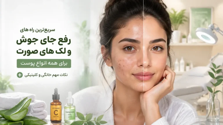 سریع‌ترین روش درمان جای جوش و لک صورت برای انواع پوست + نکات مهم در خانه و کلینیک