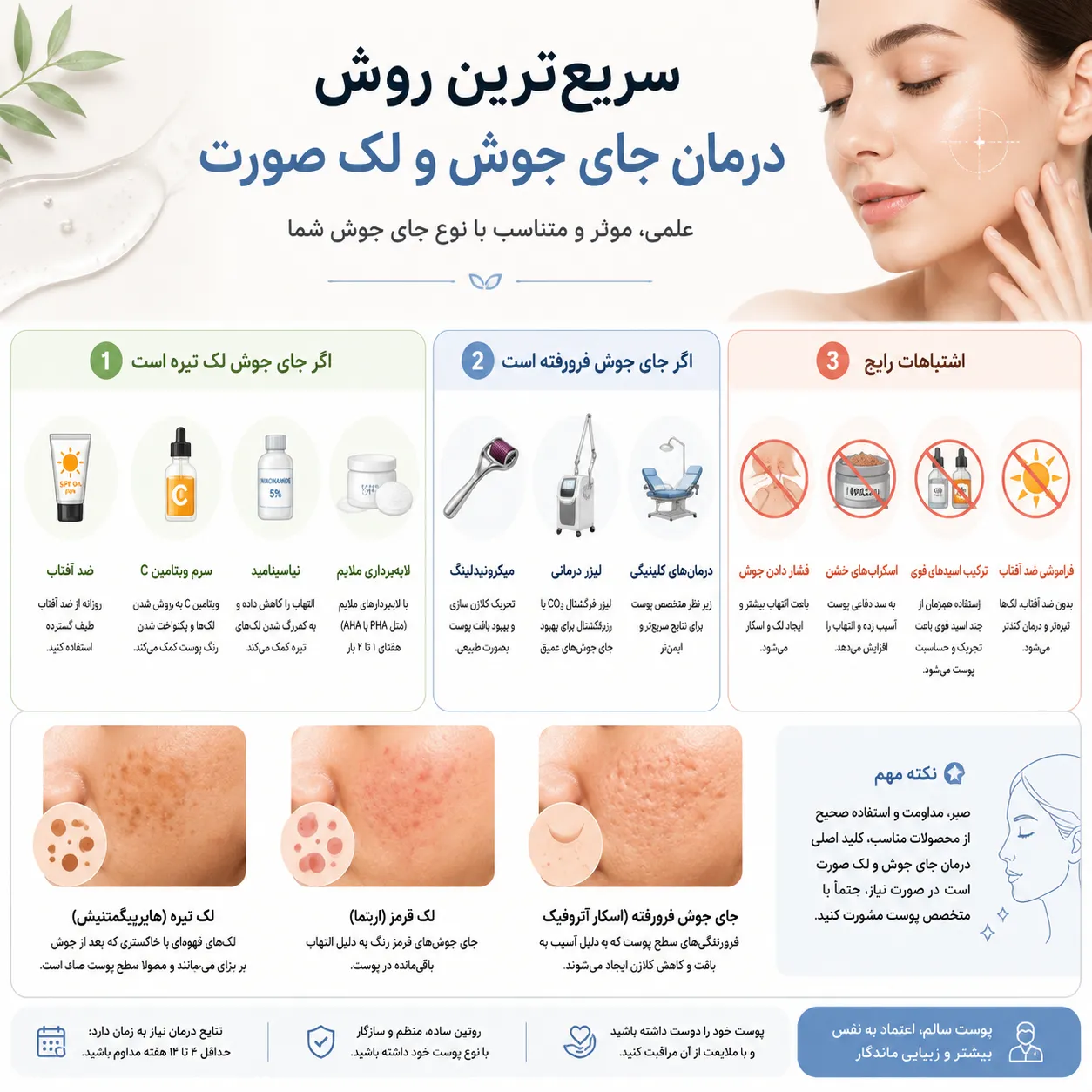 سریعترین روش درمان جای جوش و لک صورت برای انواع پوست + نکات مهم در خانه و کلینیک سریعترین روش درمان جای جوش و لک صورت برای انواع پوست + نکات مهم در خانه و کلینیک