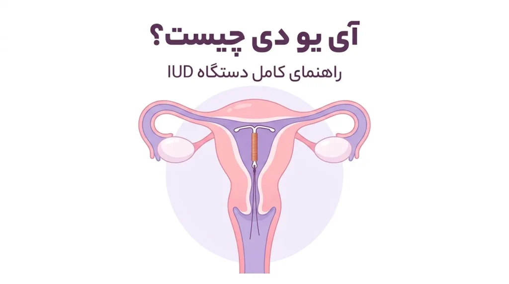 آی یو دی چیست؟ نحوه گذاشتن، عوارض و مراقبت‌های بعد از IUD