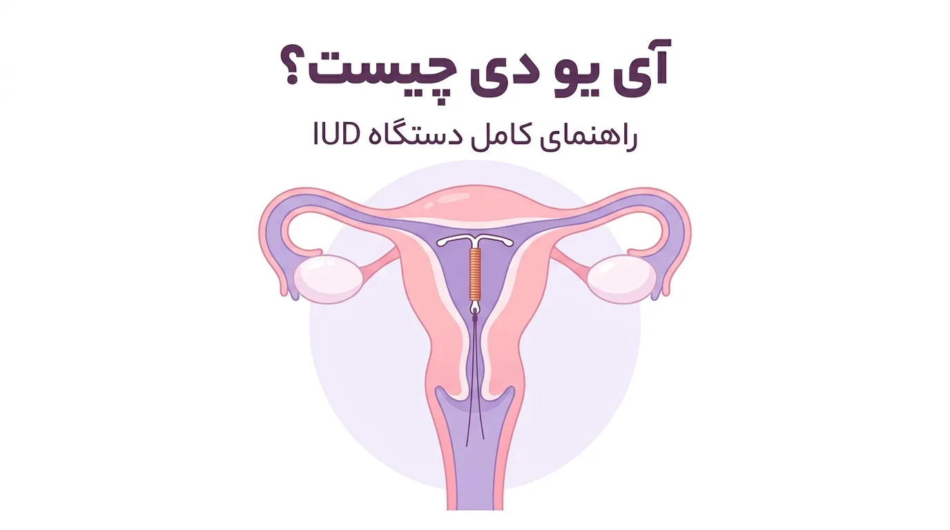 آی یو دی چیست؟ راهنمای کامل دستگاه IUD، نحوه گذاشتن، عوارض و مراقبت‌ها